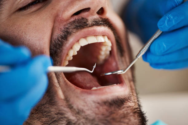 Best Urgent Dental Care for Toothache in Chase, PA