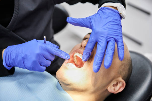 Best Emergency Dental Services for Seniors in Chase, PA